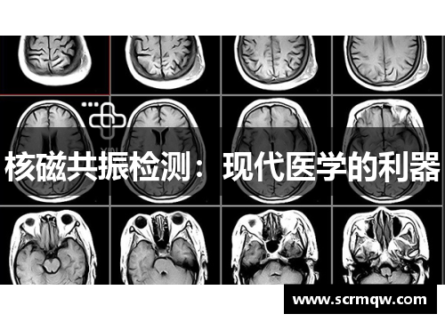 核磁共振检测：现代医学的利器